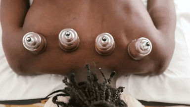 Image for Cupping Massage Online Booking